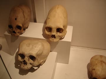 Elongated Inca skulls.